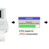 Bionet FC1400 Fetal Monitor (CTG Machine)